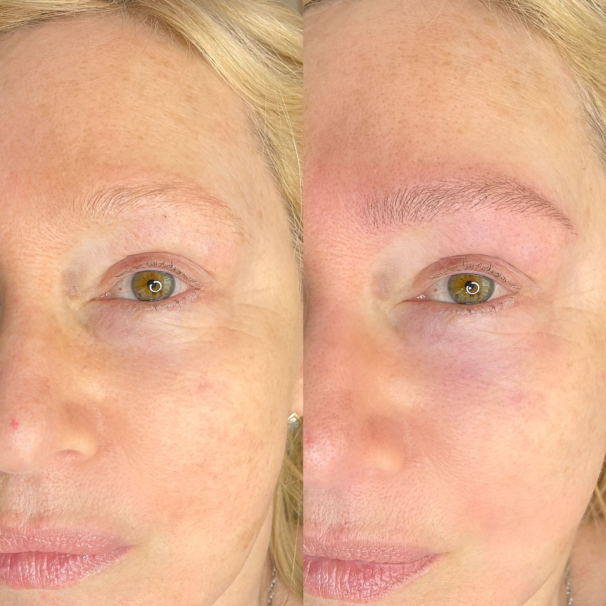NanoBrows Alopecia antes y después
