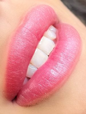 Labios