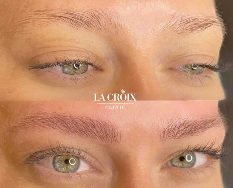 NanoBrows Alopecia, reconstrucción de cejas