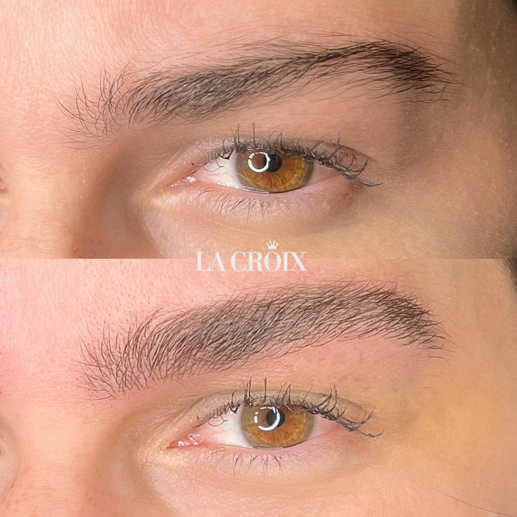Cejas con Nanoblading Light Brows en La Croix Clinic