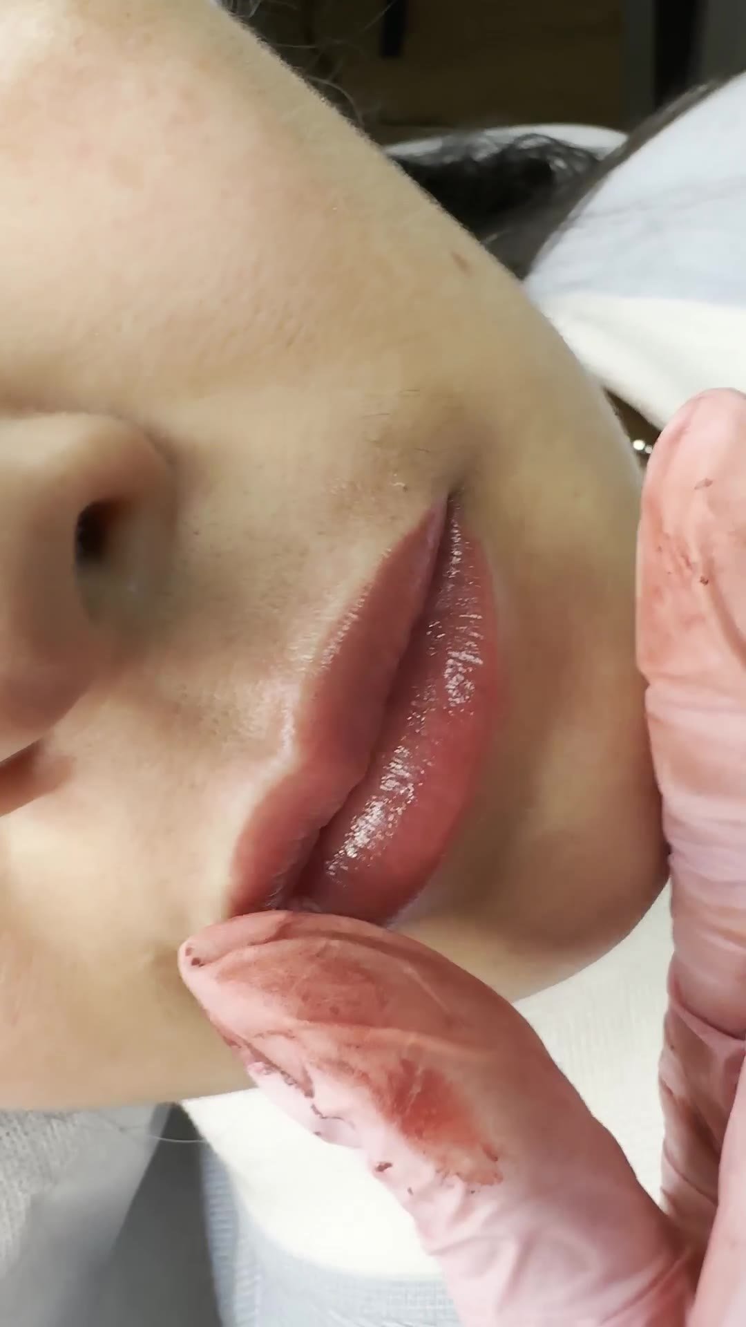 Nanopigmentación labial en La Croix, Carrasco