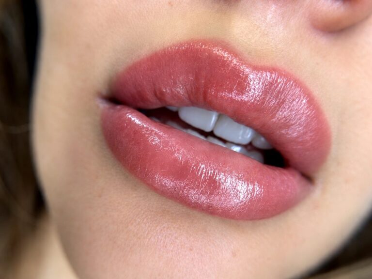 Neutralización de labios oscuros