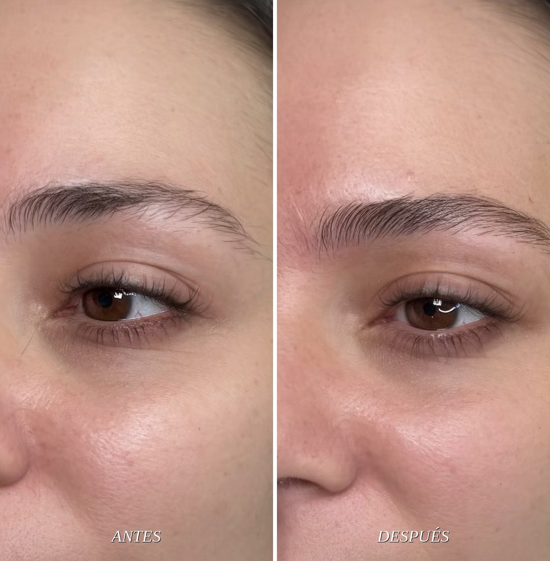 Antes y después de Nanoblading