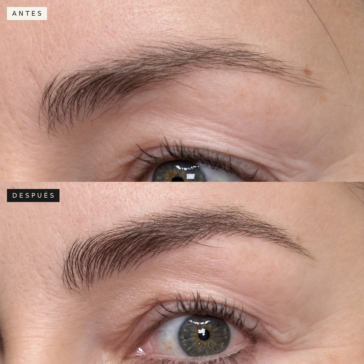 Antes y después de Nanoblading Light Brows en La Croix, Carrasco