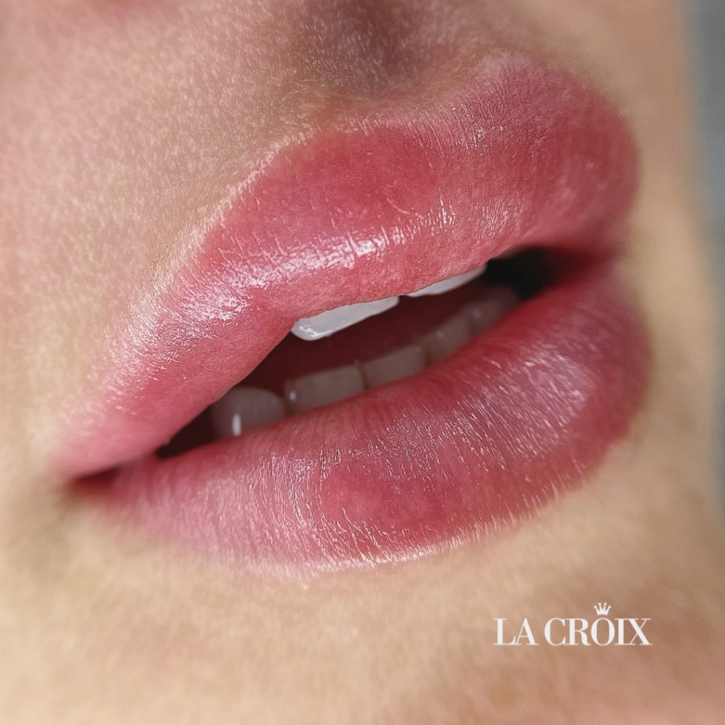 Labios con nanopigmentación en La Croix Clinic