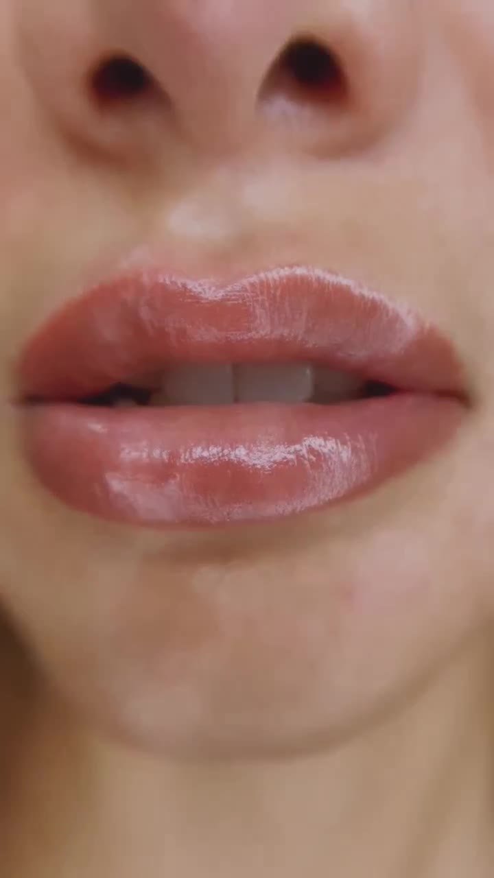 Neutralización de labios oscuros: antes y después